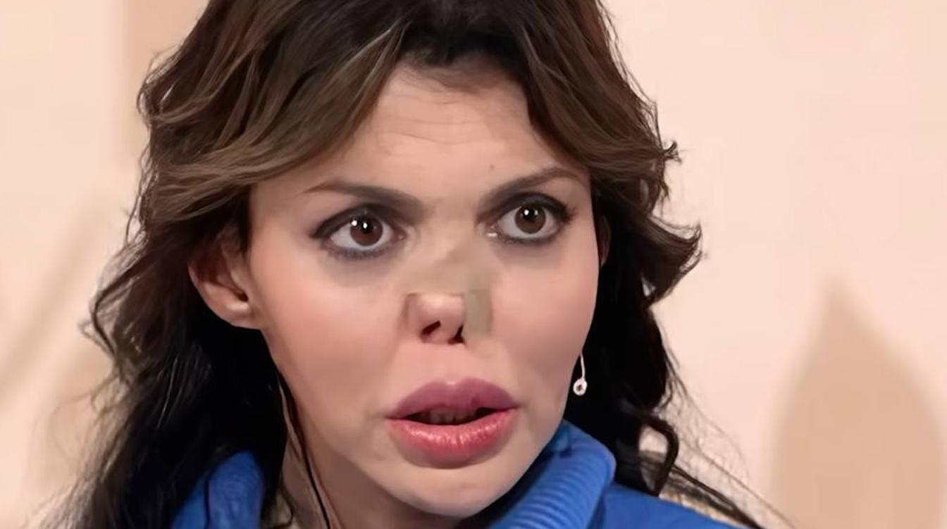 Алиса Аршавина раскрыла реальную причину потери носа